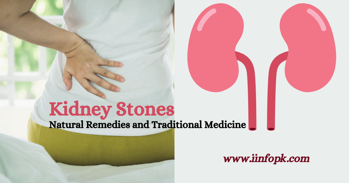 Kidney Stones3 Natural Remedies and Traditional Medicine